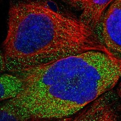 LRSAM1 Antibody, Novus Biologicals 0.1mL; Unlabeled:Antibodies, Polyclonal